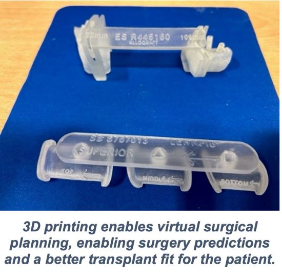 3D Printing Quickens Craniomaxillofacial Tumour Surgery